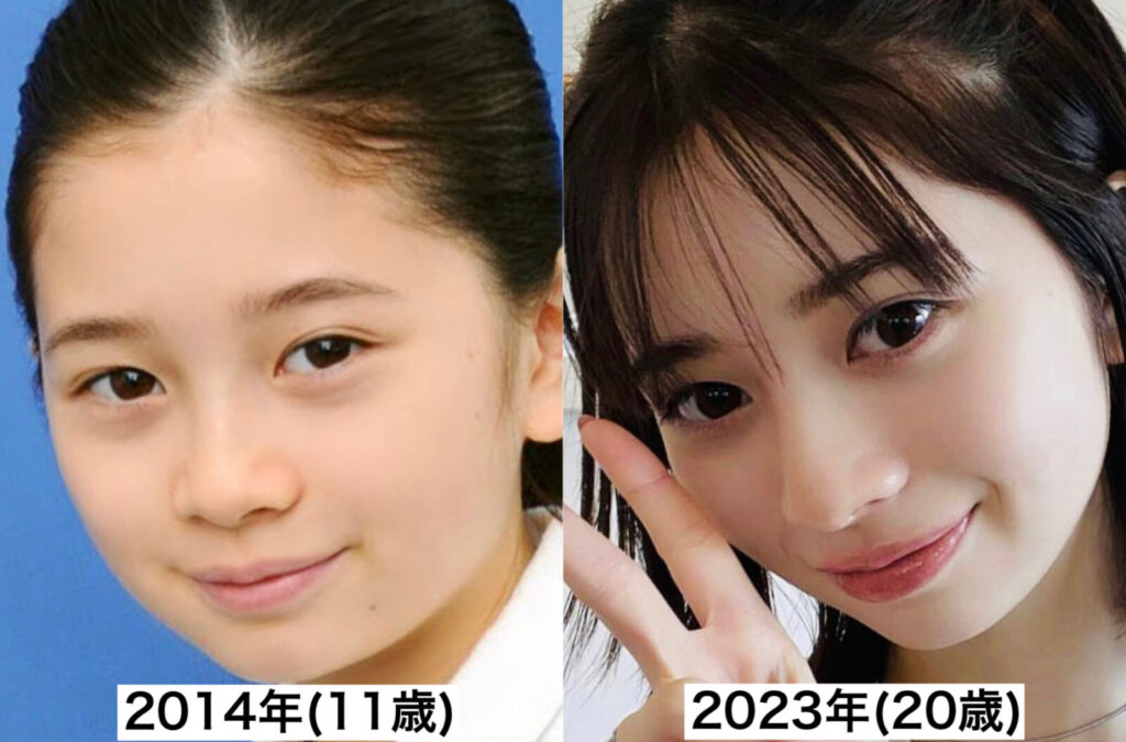桜田ひよりの過去と今を比較した写真
