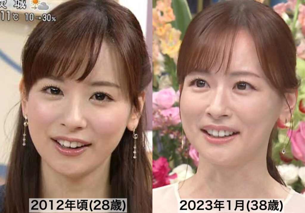 過去と現在の皆藤愛子の比較写真