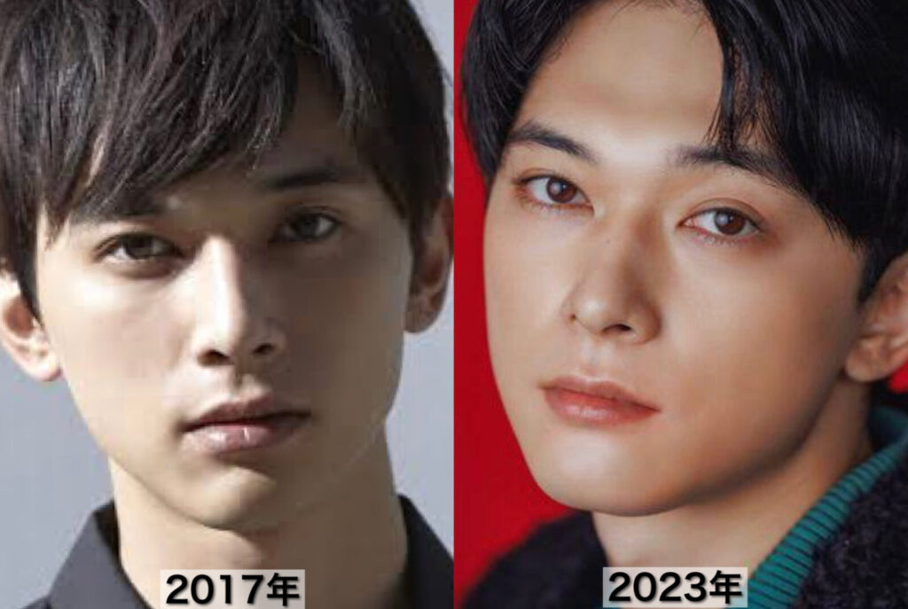 吉沢亮の過去と現在の比較写真
