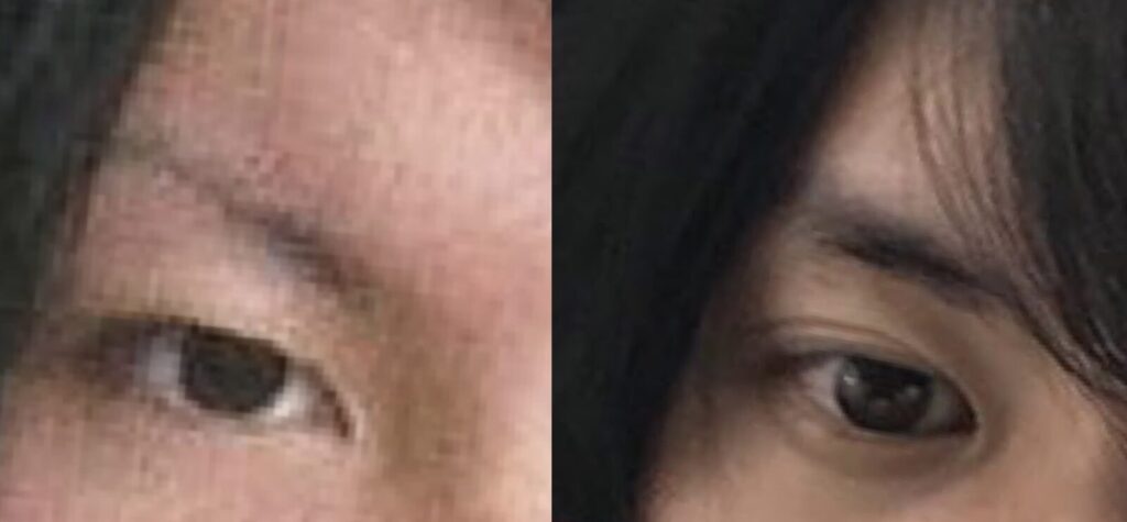 2枚の目の比較